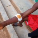 Chief allegedly shoots 18-year-old at Sehwi Kwasikrom amid tensions