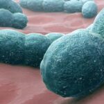 Meningococcal meningitis