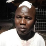 One injured in attack on Tolon Chief who allegedly endorsed Bawumia and cursed NDC Tolon Chief who declared support for Bawumia and rained curses on National Democratic Congress (NDC) voters.