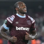 Antonio has surgery on lower limb fracture after crash
