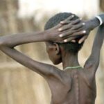 Conflict in Bawku worsens malnutrition crisis, claims two lives 