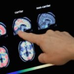 Up to 4 in 10 people could develop dementia after 55; What you can do to lower your risk