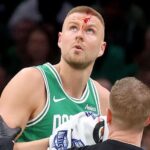 Porzingis suffers head wound as Celtics beat Magic