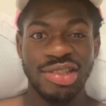 Lil Nas X in hospital with partial face paralysis