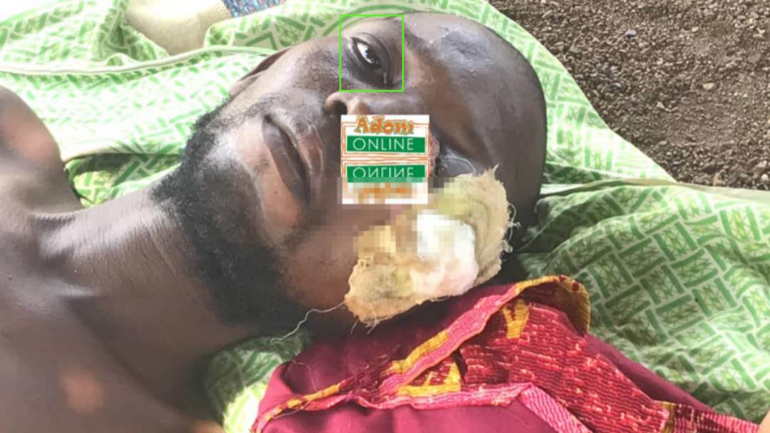 38-year-old man appeals for support to undergo urgent eye treatment