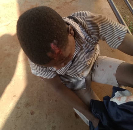 One of the affected students sits on the floor with a head injury.