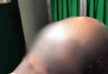 Okada rider survives brutal machete attack in Boinso, suspect arrested