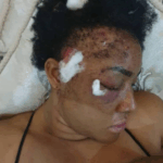 Angela Okorie reveals bullet fragments still in her head after 2019 assassination attempt