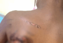 Mother faces Ho court for allegedly burning son over lost pen