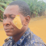 Two police officers injured in Kukurantumi clash after suspect’s death