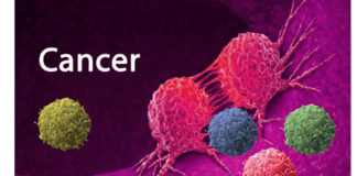 Joy Cancer Month Awareness Series: All that you missed in one click