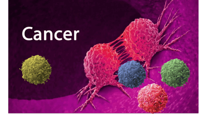 cancer-727x424