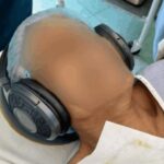 Music eases surgery and speeds recovery, Indian study finds