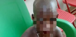 Kenyasi assault case: Woman jailed 15-months for injuring child