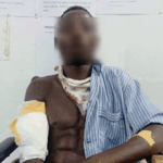Man inflicts cutlass wounds on 25-year-old at Nzema Nkwanta