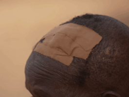 ‘Blood was all over’ – victim of Nigeria church abduction describes escape