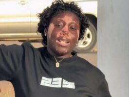 “Everybody looks at me differently; some say I’m pretty” – Abigail Anderson opens up on living with vitiligo