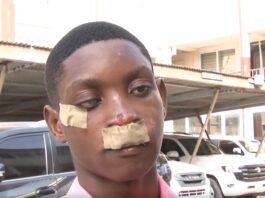 Obrachire SHS victim demands justice after brutal attack at inter-schools event