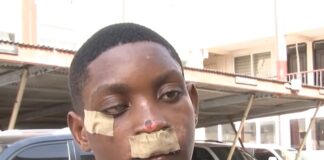 Obrachire SHS victim demands justice after brutal attack at inter-schools event