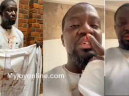 Artiste Ibrahim Mahama alleges assault by police special operations team in Tamale