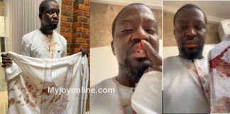 Artiste Ibrahim Mahama alleges assault by police special operations team in Tamale