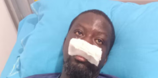 Artiste Ibrahim Mahama alleges assault by police special operations team in Tamale