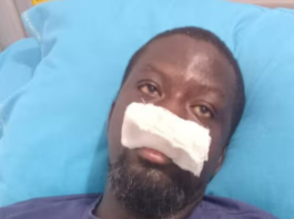 Police probe alleged assault on artist Ibrahim Mahama