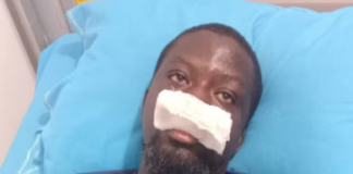 Police probe alleged assault on artist Ibrahim Mahama