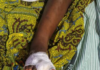 Mother arrested for allegedly severing daughter’s toe in Juaboso