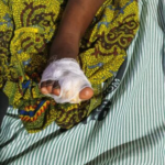 Mother arrested for allegedly severing daughter’s toe in Juaboso