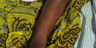 Mother arrested for allegedly severing daughter’s toe in Juaboso