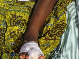 Mother arrested for allegedly severing daughter’s toe in Juaboso