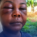 Jealous wife allegedly attacks husband’s side chick at Agona Nyakrom