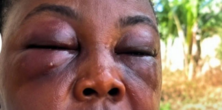 Jealous wife allegedly attacks husband’s side chick at Agona Nyakrom
