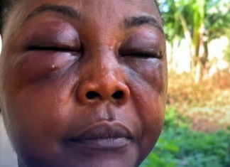 Jealous wife allegedly attacks husband’s side chick at Agona Nyakrom