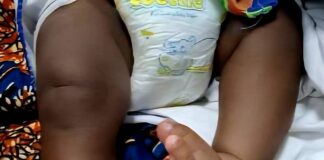 Over 9,000 Ghanaian children receive free life-changing treatment for clubfoot as experts push for early detection