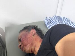 Adwoa Safo reportedly injured in shooting incident