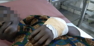 Student injured in cutlass attack over alleged sexual harassment at Assin Krofofrodo