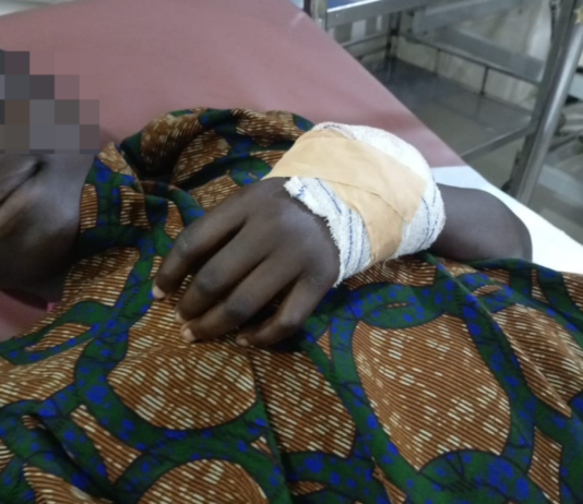 Student injured in cutlass attack over alleged sexual harassment at Assin Krofofrodo