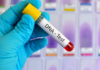 Why Ghana should consider mandatory DNA testing at birth: A public health and societal imperative