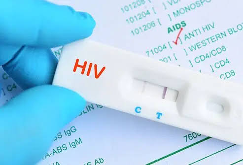 Ghana risks potential shortage of HIV testing kits by end of July