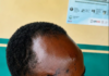 Okada rider allegedly drives motorbike key into man’s skull during fight over passenger
