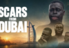 Scars From Dubai: 28-year-old fights to rebuild his life after acid attack by a Ghanaian disfigured him
