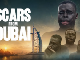 Scars From Dubai: 28-year-old fights to rebuild his life after acid attack by a Ghanaian disfigured him
