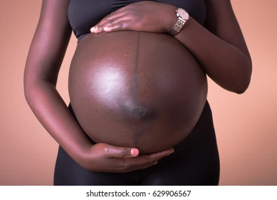 When the belly begins to speak: The beautiful mystery of pregnancy’s dark mark